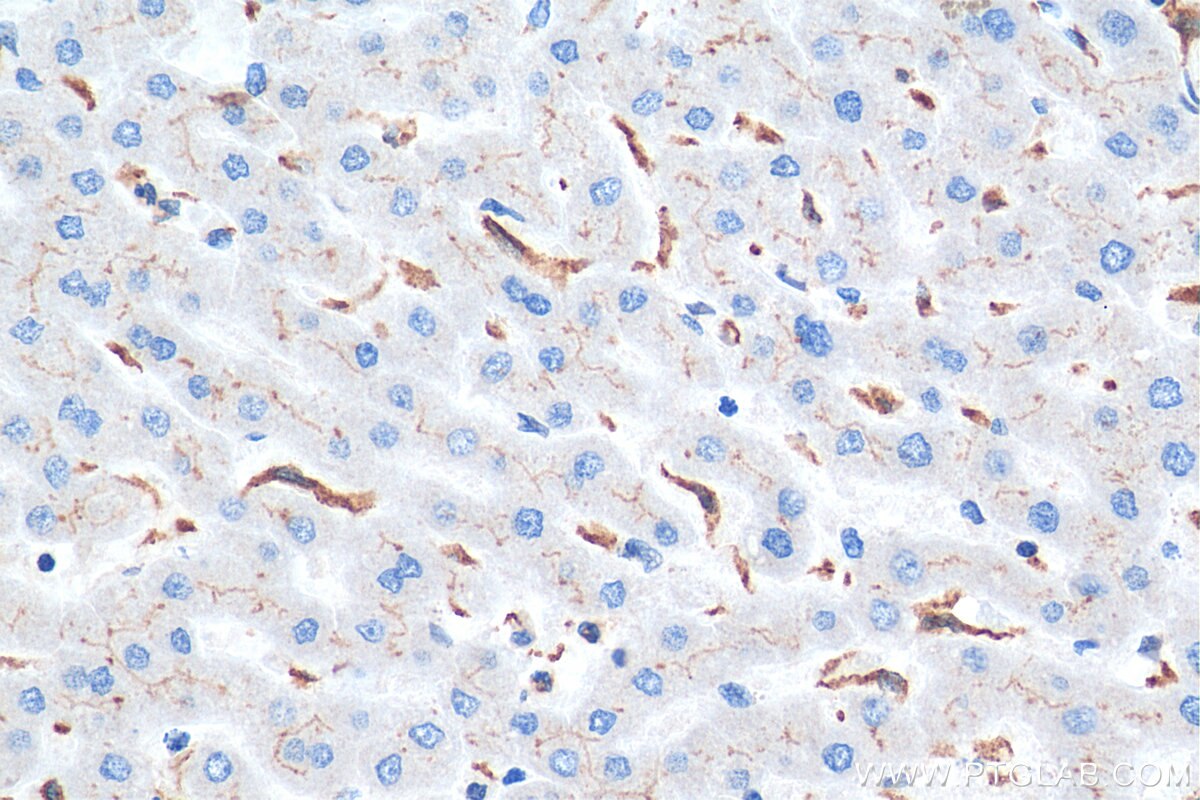 Immunohistochemistry (IHC) staining of human liver tissue using BSEP Polyclonal antibody (18990-1-AP)