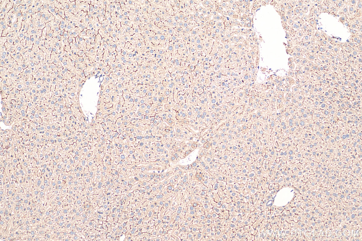 Immunohistochemistry (IHC) staining of mouse liver tissue using BSEP Polyclonal antibody (18990-1-AP)