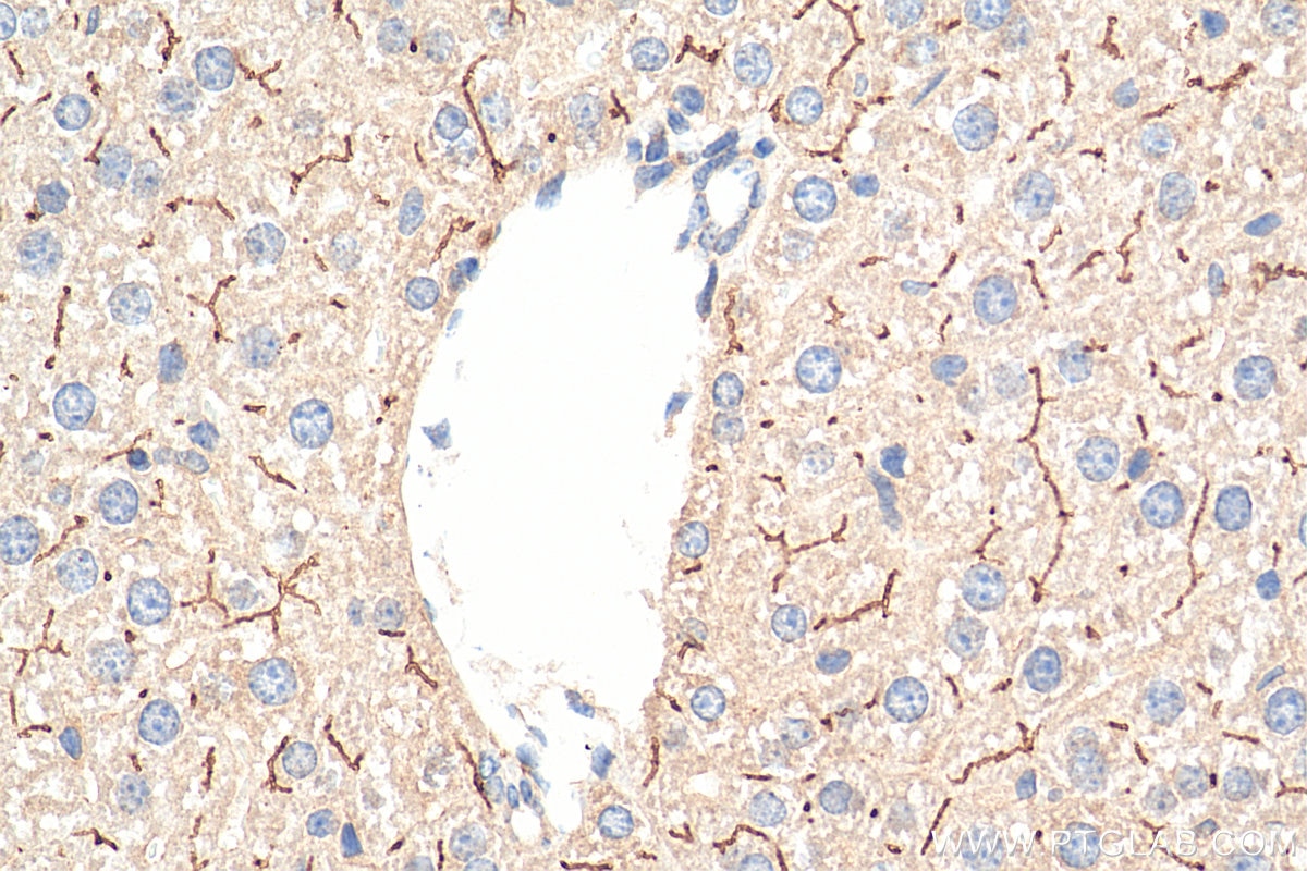 Immunohistochemistry (IHC) staining of mouse liver tissue using BSEP Polyclonal antibody (18990-1-AP)