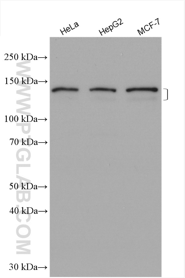 Western Blot (WB) analysis of various lysates using ABCB4 Polyclonal antibody (27726-1-AP)