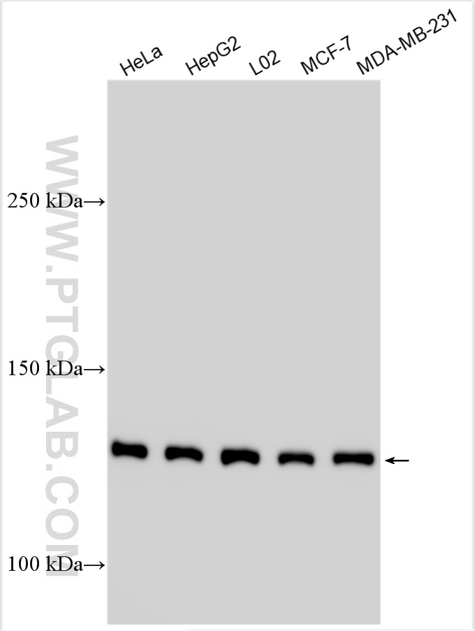 Western Blot (WB) analysis of various lysates using ABCB4 Polyclonal antibody (27726-1-AP)