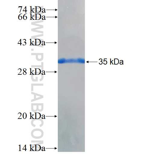 ABCB4 fusion protein Ag26840 SDS-PAGE