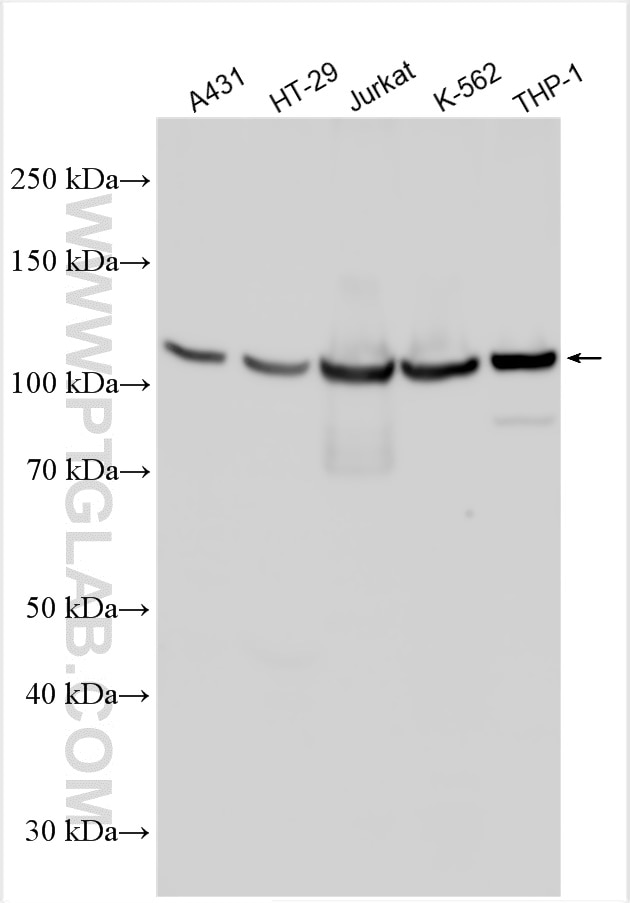 Western Blot (WB) analysis of various lysates using ABCB5 Polyclonal antibody (20703-1-AP)