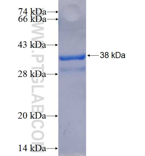 ABCB5 fusion protein Ag25938 SDS-PAGE