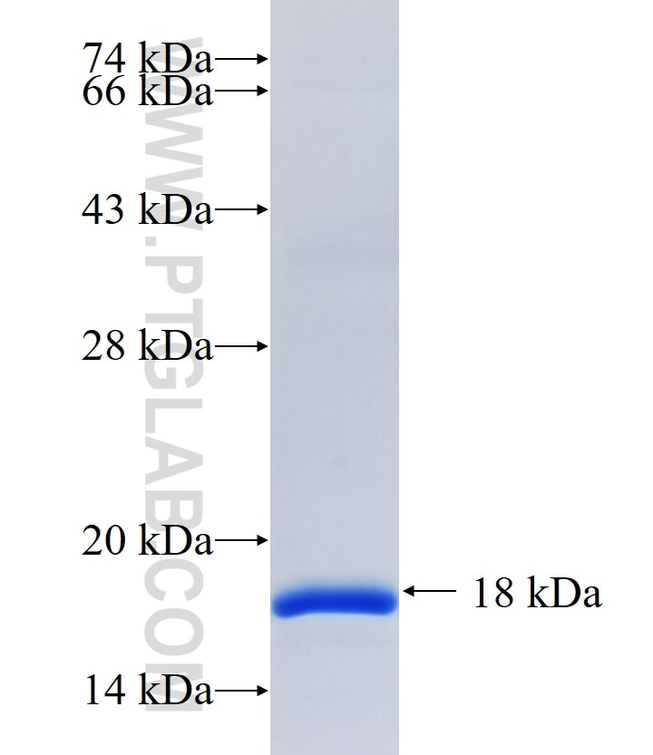 ABCB5 fusion protein Ag17700 SDS-PAGE