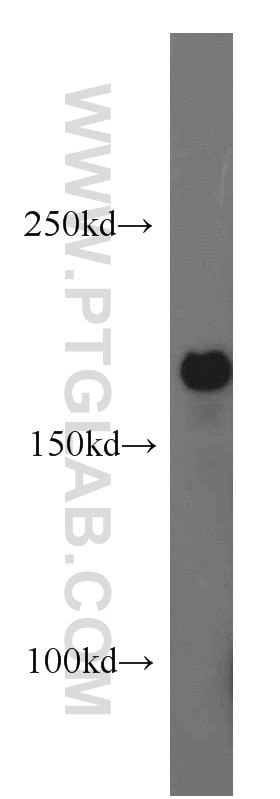 Western Blot (WB) analysis of mouse brain tissue using ABCB6 Polyclonal antibody (14996-1-AP)