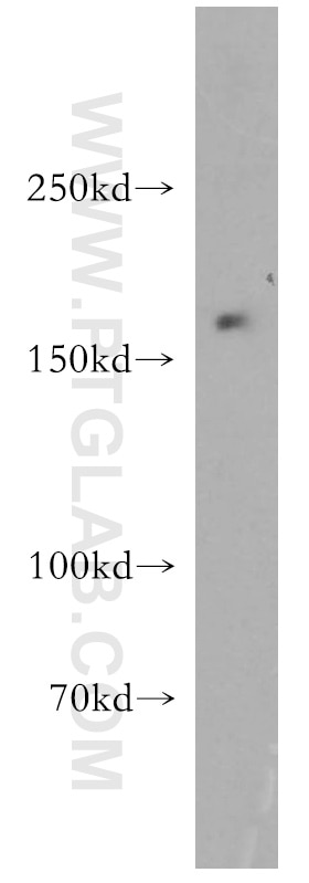 Western Blot (WB) analysis of mouse brain tissue using ABCB6 Polyclonal antibody (14996-1-AP)