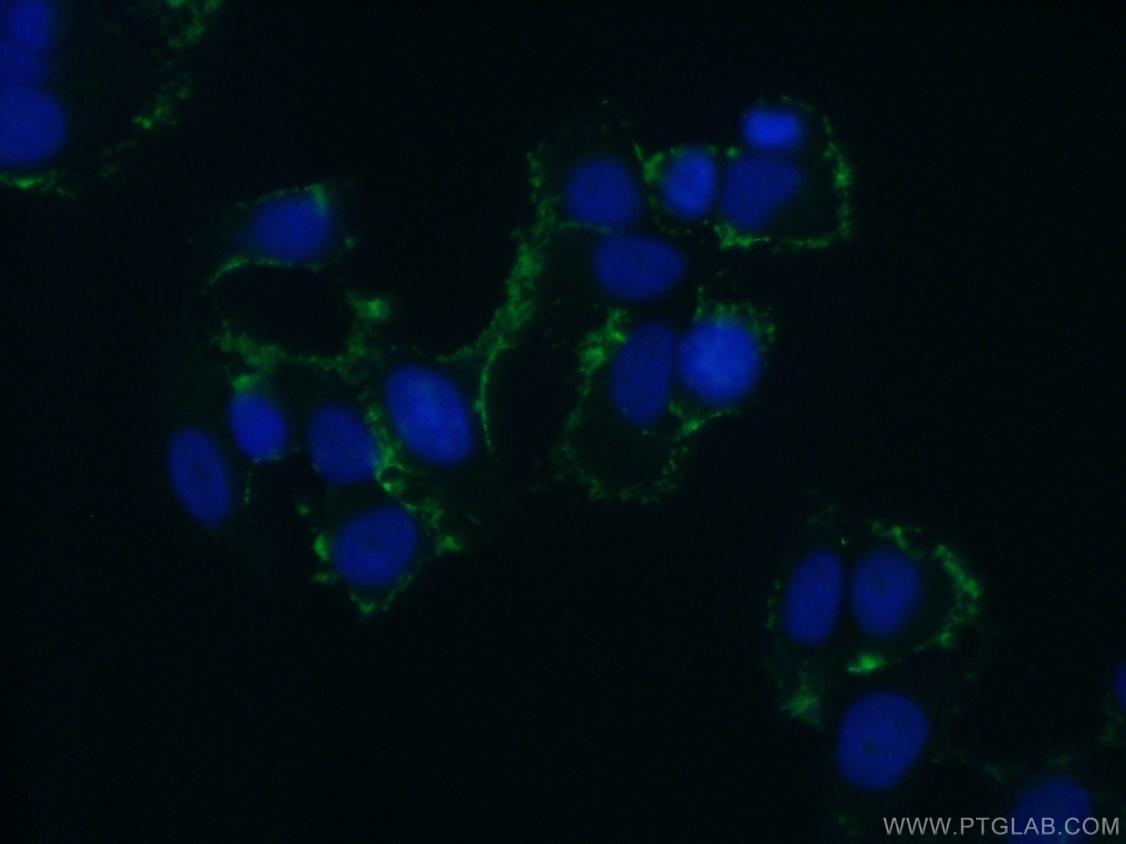 Immunofluorescence (IF) / fluorescent staining of MCF-7 cells using ABCB6 Polyclonal antibody (51007-1-AP)