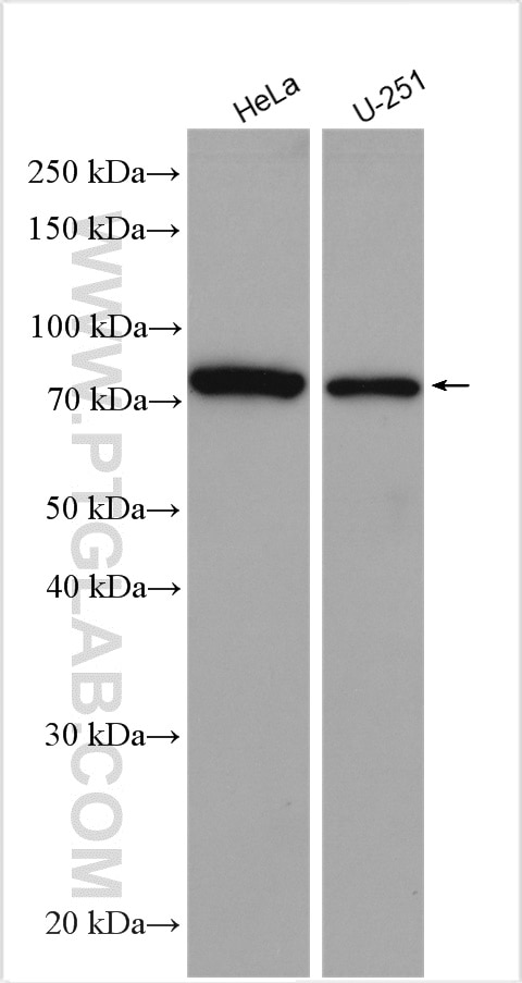 Western Blot (WB) analysis of various lysates using ABCB6 Polyclonal antibody (51007-1-AP)