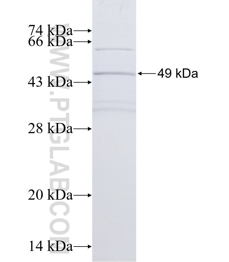 ABCB6 fusion protein Ag0461 SDS-PAGE