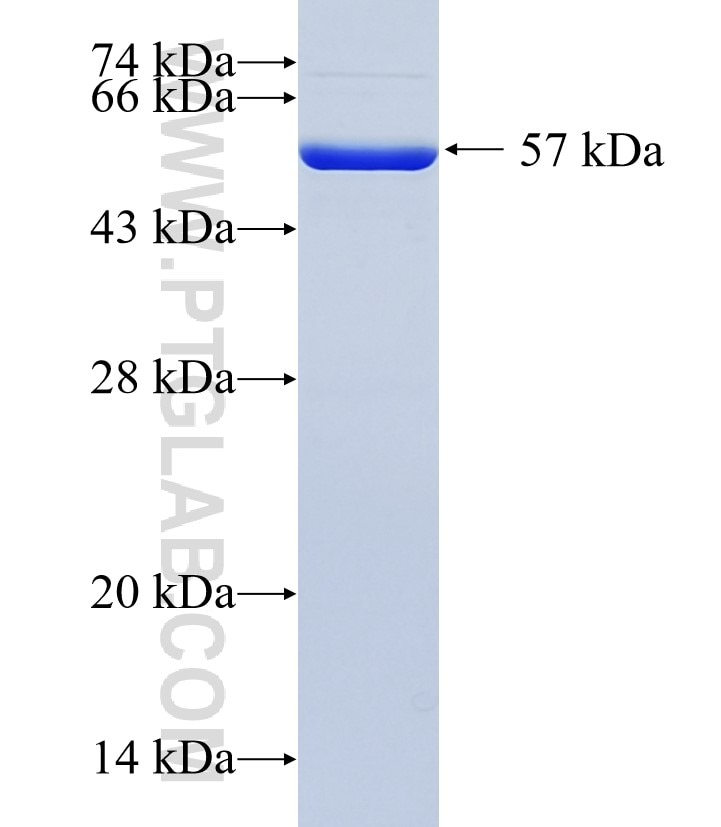 ABCB6 fusion protein Ag6982 SDS-PAGE