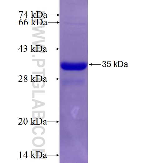 ABCB6 fusion protein Ag7045 SDS-PAGE