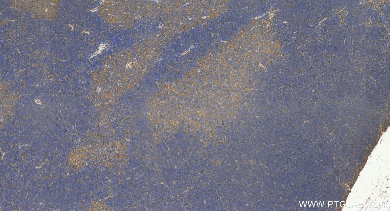 IHC staining of mouse thymus using 11158-1-AP Immunohistochemistry (IHC) staining of mouse thymus tissue using ABCB7 Polyclonal antibody (11158-1-AP)