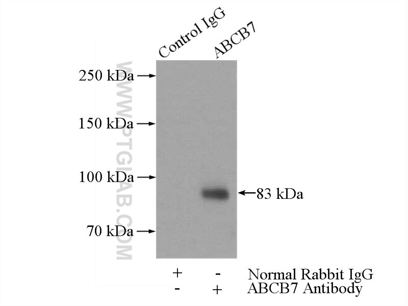 Immunoprecipitation (IP) experiment of mouse liver tissue using ABCB7 Polyclonal antibody (11158-1-AP)