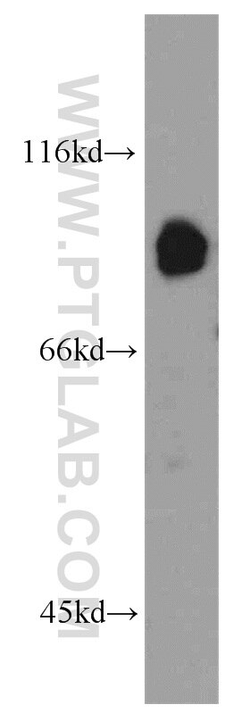 Western Blot (WB) analysis of mouse liver tissue using ABCB7 Polyclonal antibody (11158-1-AP)