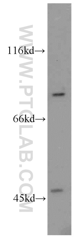 Western Blot (WB) analysis of mouse thymus tissue using ABCB7 Polyclonal antibody (11158-1-AP)