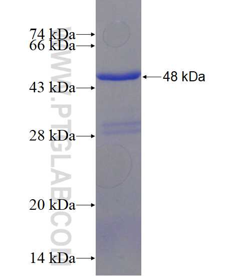 ABCB7 fusion protein Ag1544 SDS-PAGE