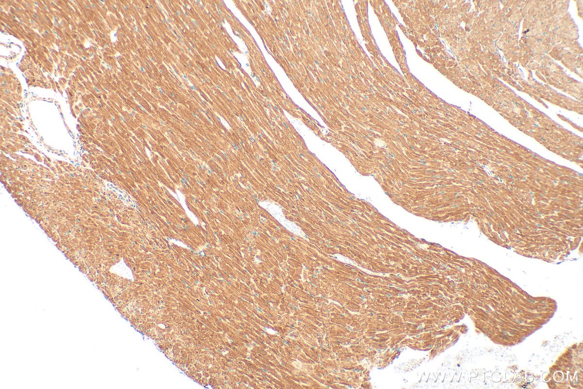 IHC staining of mouse heart using 25867-1-AP Immunohistochemistry (IHC) staining of mouse heart tissue using ABCB8 Polyclonal antibody (25867-1-AP)