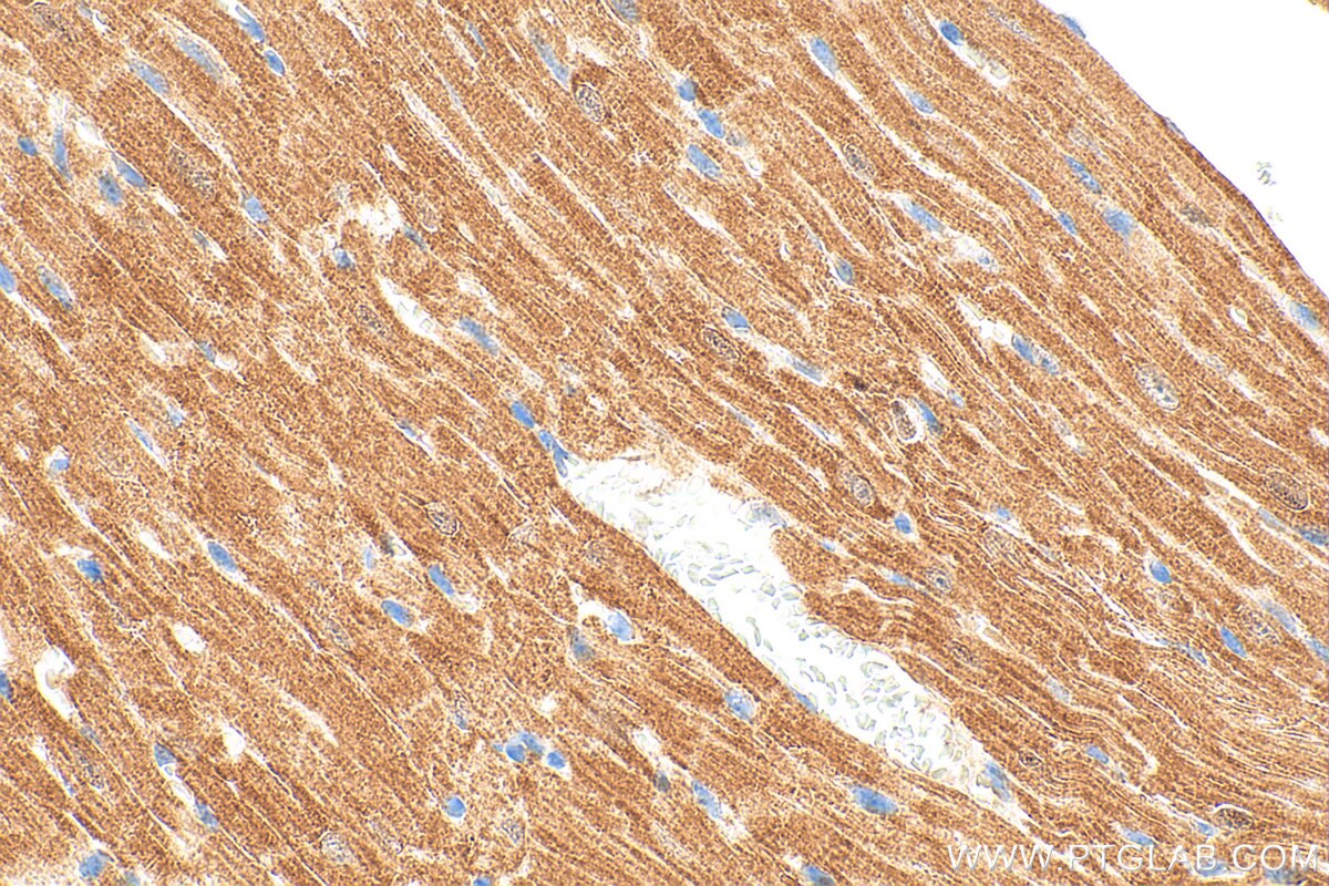IHC staining of mouse heart using 25867-1-AP Immunohistochemistry (IHC) staining of mouse heart tissue using ABCB8 Polyclonal antibody (25867-1-AP)