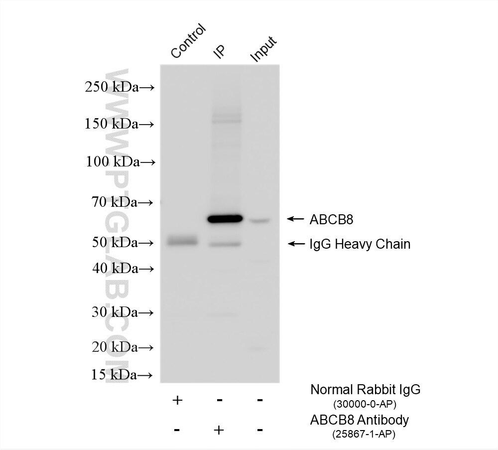 IP experiment of rat heart using 25867-1-AP Immunoprecipitation (IP) experiment of rat heart tissue using ABCB8 Polyclonal antibody (25867-1-AP)