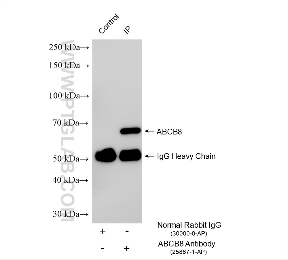IP experiment of HepG2 using 25867-1-AP Immunoprecipitation (IP) experiment of HepG2 cells using ABCB8 Polyclonal antibody (25867-1-AP)