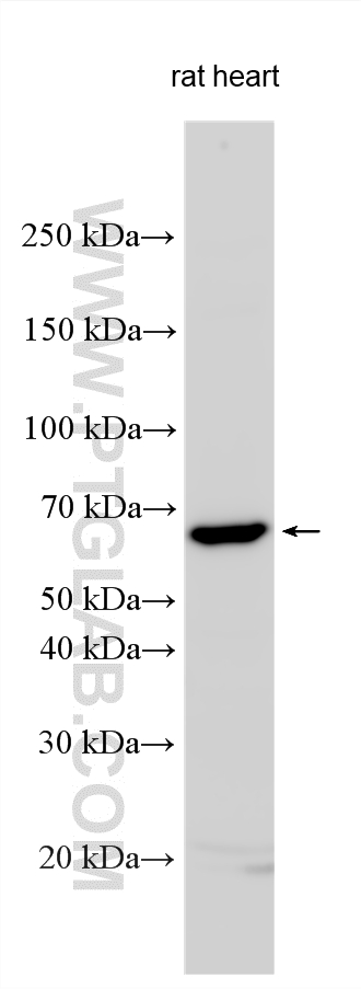 WB analysis using 25867-1-AP Western Blot (WB) analysis of various lysates using ABCB8 Polyclonal antibody (25867-1-AP)