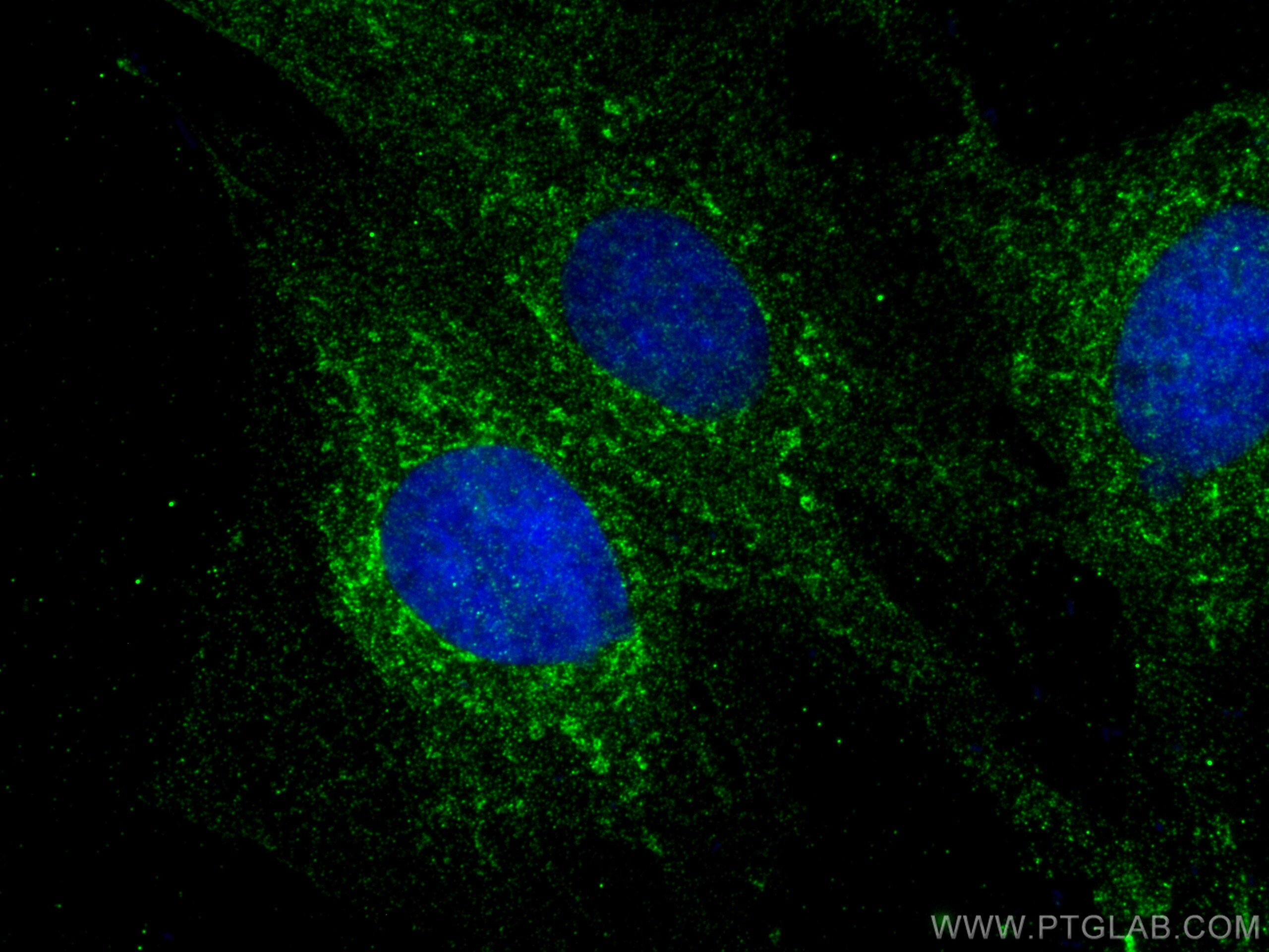 Immunofluorescence (IF) / fluorescent staining of H9C2 cells using ABCB8 Polyclonal antibody (27158-1-AP)