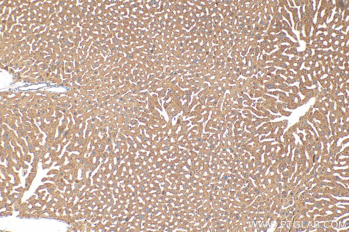 Immunohistochemistry (IHC) staining of mouse liver tissue using ABCB8 Polyclonal antibody (27158-1-AP)