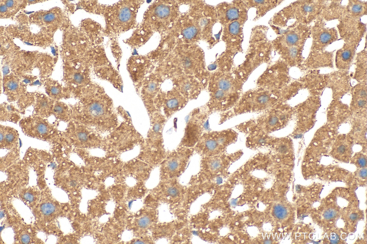 Immunohistochemistry (IHC) staining of mouse liver tissue using ABCB8 Polyclonal antibody (27158-1-AP)