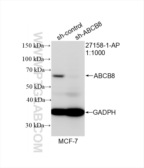 Western Blot (WB) analysis of MCF-7 cells using ABCB8 Polyclonal antibody (27158-1-AP)
