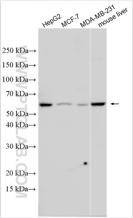 Western Blot (WB) analysis of various lysates using ABCB8 Polyclonal antibody (27158-1-AP)