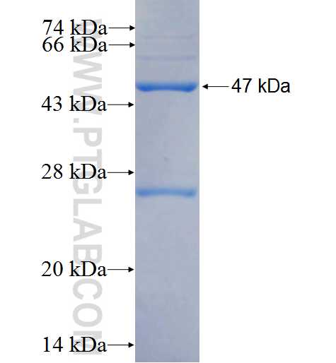 ABCB8 fusion protein Ag25935 SDS-PAGE
