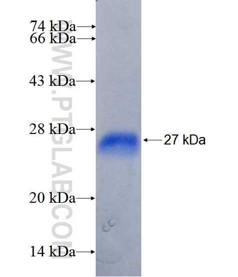 ABCB8 fusion protein Ag25962 SDS-PAGE