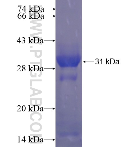 ABCB8 fusion protein Ag15304 SDS-PAGE