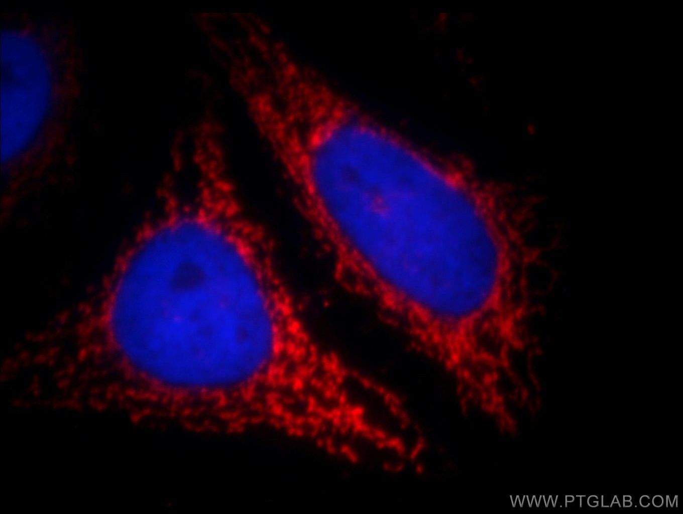 Immunofluorescence (IF) / fluorescent staining of HepG2 cells using ABCB9 Polyclonal antibody (11066-1-AP)