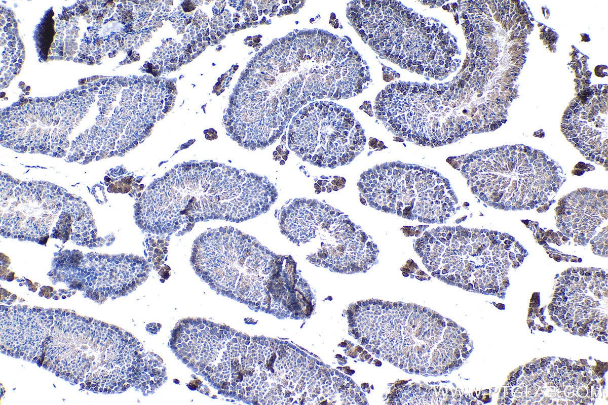 Immunohistochemistry (IHC) staining of mouse testis tissue using ABCB9 Polyclonal antibody (11066-1-AP)