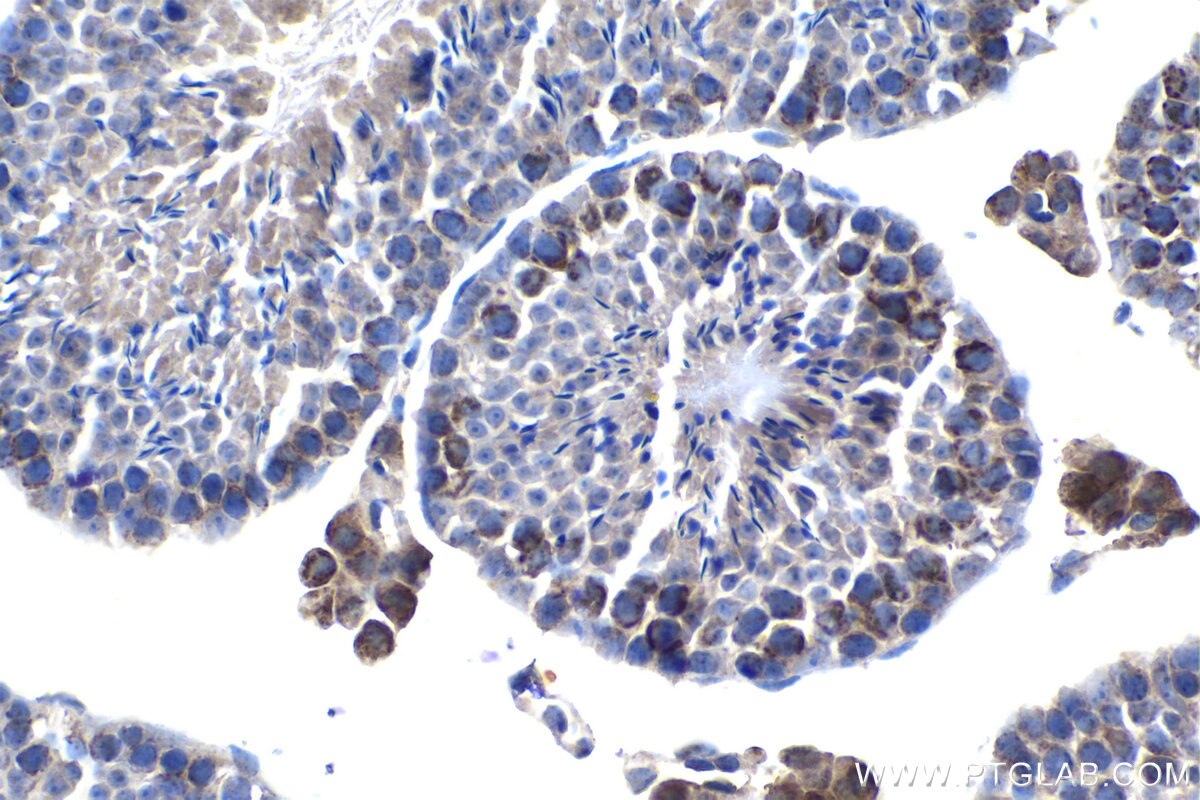 Immunohistochemistry (IHC) staining of mouse testis tissue using ABCB9 Polyclonal antibody (11066-1-AP)