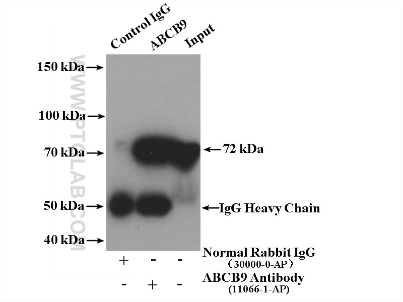 Immunoprecipitation (IP) experiment of mouse thymus tissue using ABCB9 Polyclonal antibody (11066-1-AP)