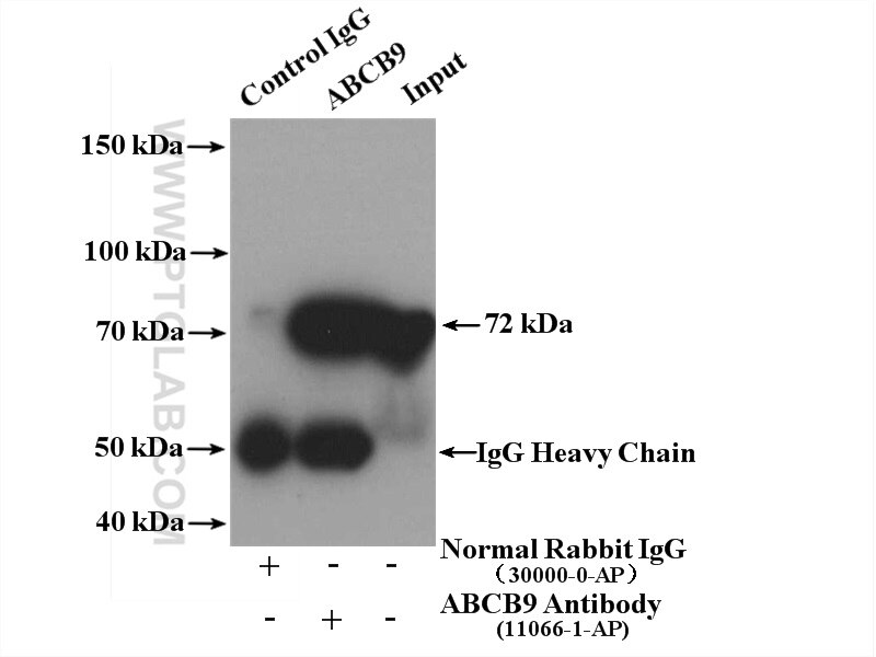 IP experiment of mouse thymus using 11066-1-AP