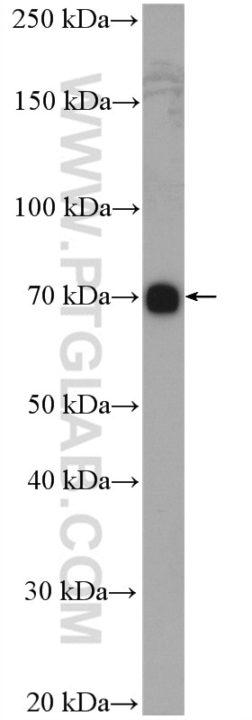 Western Blot (WB) analysis of BGC-823 cells using ABCB9 Polyclonal antibody (11066-1-AP)