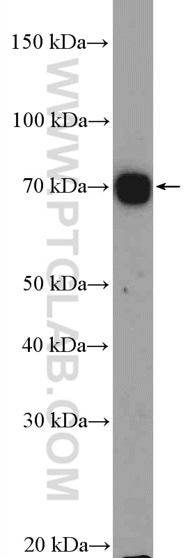 Western Blot (WB) analysis of K-562 cells using ABCB9 Polyclonal antibody (11066-1-AP)