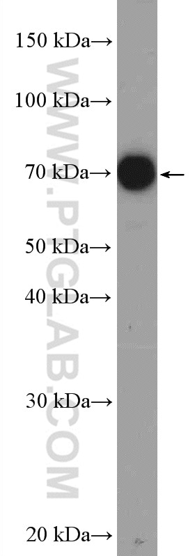 Western Blot (WB) analysis of mouse thymus tissue using ABCB9 Polyclonal antibody (11066-1-AP)