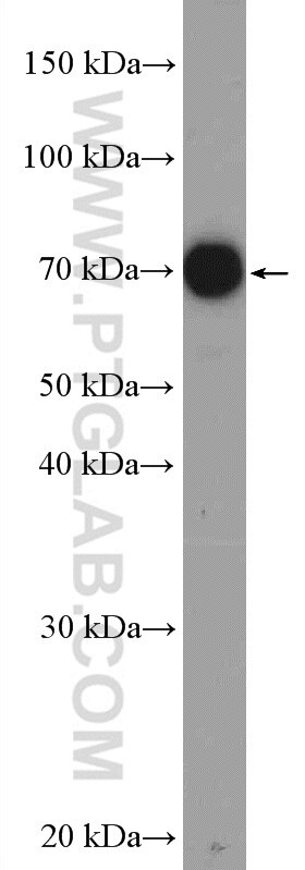 WB analysis of mouse thymus using 11066-1-AP