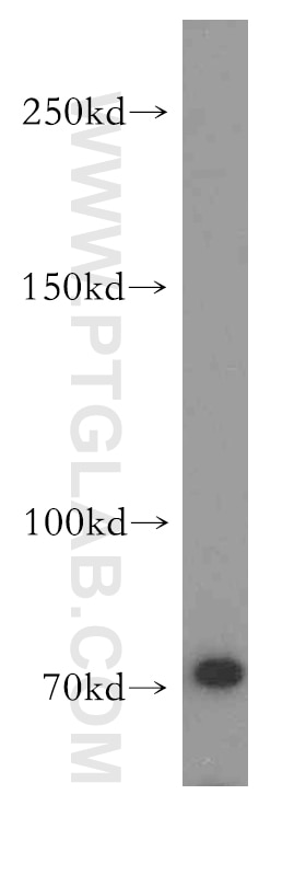 Western Blot (WB) analysis of HL-60 cells using ABCB9 Polyclonal antibody (11066-1-AP)