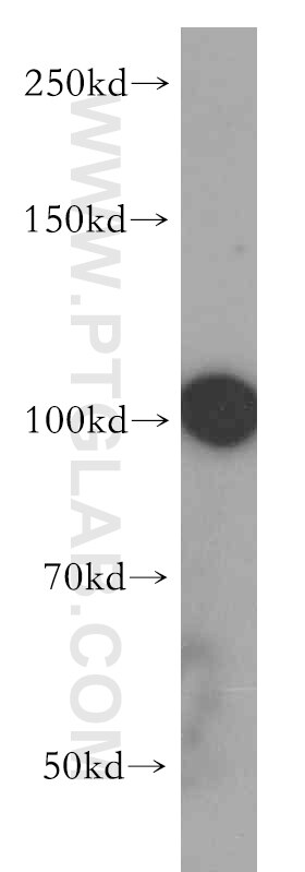 Western Blot (WB) analysis of human testis tissue using ABCB9 Polyclonal antibody (11066-1-AP)