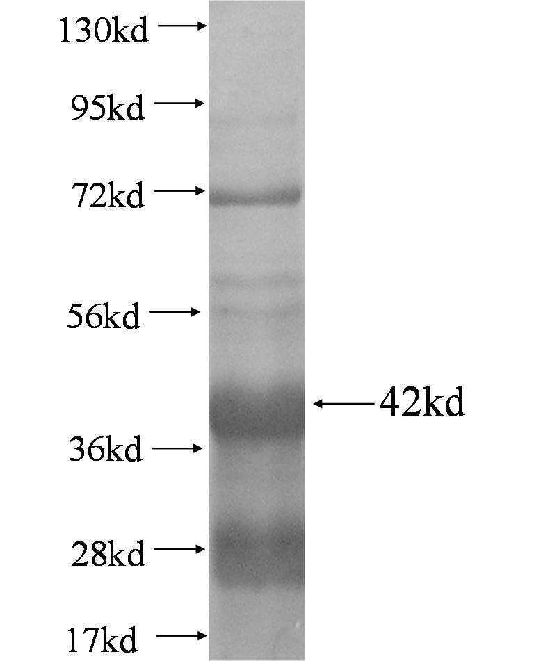ABCB9 fusion protein Ag0458 SDS-PAGE