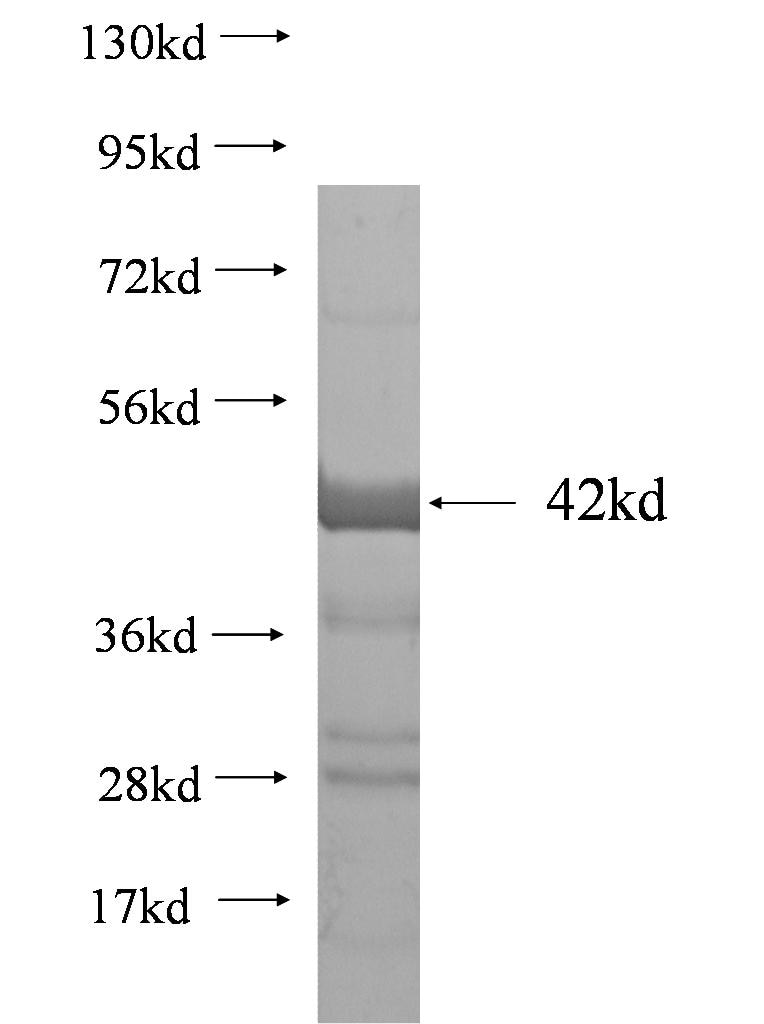 ABCB9 fusion protein Ag1542 SDS-PAGE
