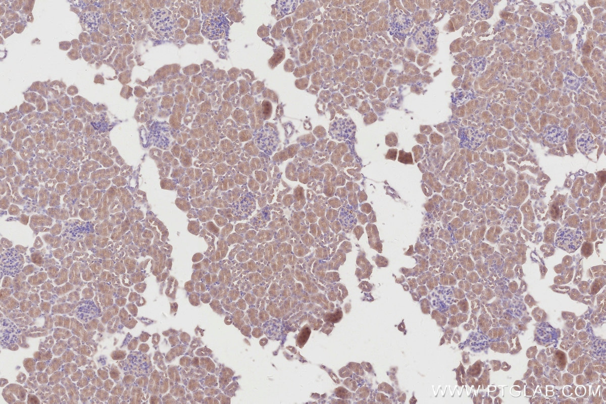 Immunohistochemistry (IHC) staining of mouse kidney tissue using MRP1 Monoclonal antibody (67228-1-Ig)