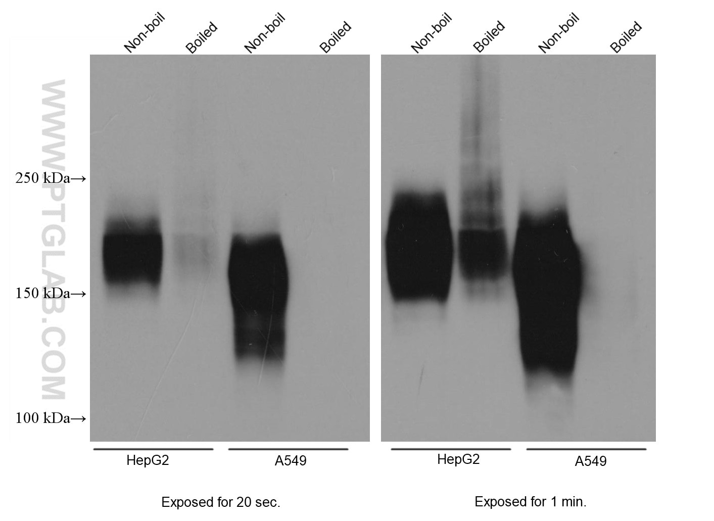 Western Blot (WB) analysis of various lysates using MRP1 Monoclonal antibody (67228-1-Ig)