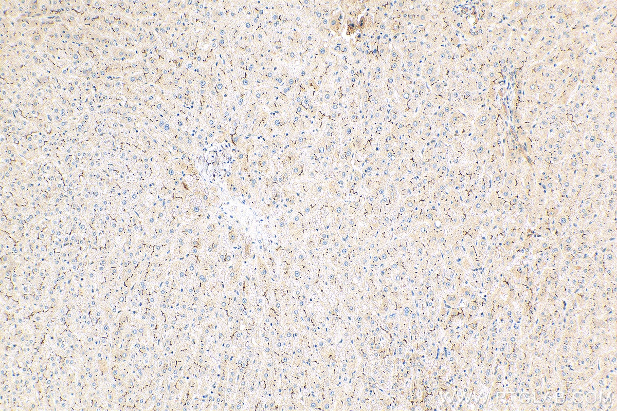 Immunohistochemistry (IHC) staining of human liver tissue using MRP2 Polyclonal antibody (29261-1-AP)